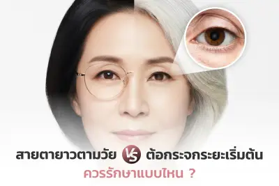 สายตายาวตามวัย vs ต้อกระจกระยะเริ่มต้น: อะไรเหมาะกับเลสิก